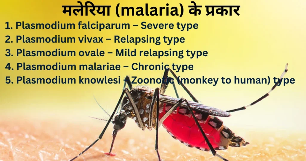 मलेरिया के प्रकार (Types of Malaria)