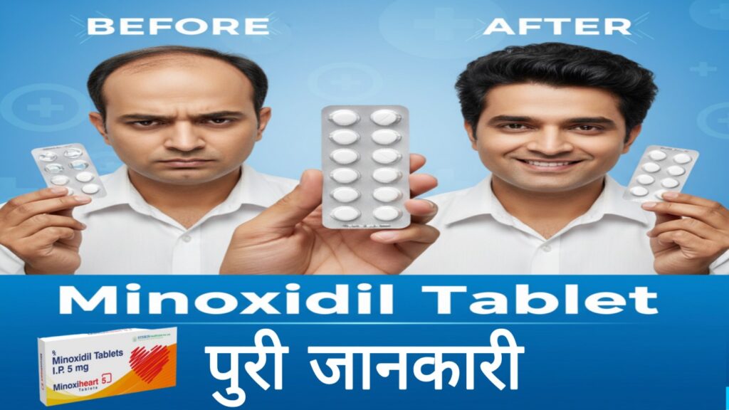 Minoxidil Tablet क्या है? बालों के झड़ने और हाई ब्लड प्रेशर के लिए पूरी जानकारी