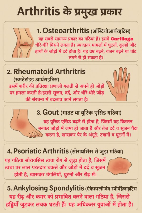 Arthritis के प्रमुख प्रकार - Osteoarthritis, Rheumatoid Arthritis, Gout, Psoriatic Arthritis, Ankylosing Spondylitis